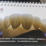 牙科阿了啊强头像