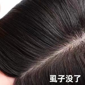 虱子大作战（我专业除虱)头像